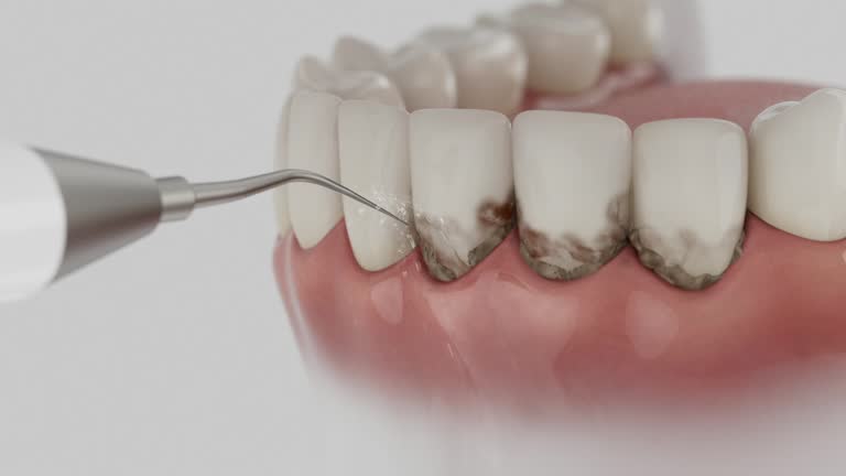Trusted Dental Crowns And Bridges service in McLean, TX - Dentist Open Now